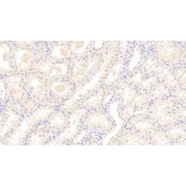 Beclin 1 (BECN1) Human Monoclonal Antibody