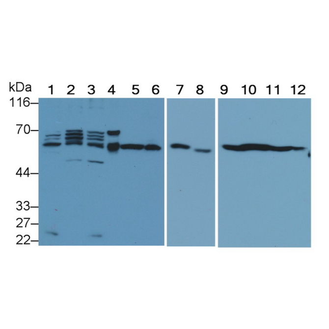 Beclin 1 (BECN1) Human Monoclonal Antibody