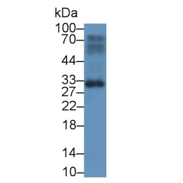 Brain Abundant, Membrane Attached Signal Protein 1 (BASP1) Human Monoclonal Antibody