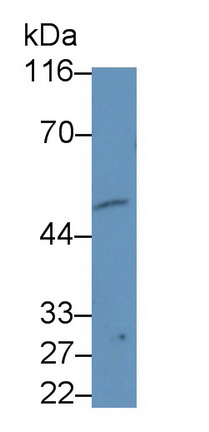Beta-1,4-N-Acetyl Galactosaminyl Transferase 2 (b4GALNT2) Human Monoclonal Antibody