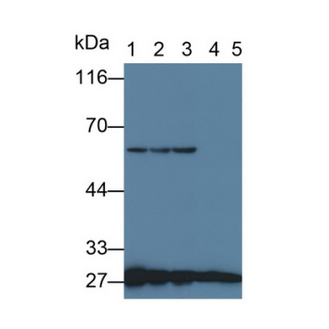 Tyrosine 3/Tryptophan 5 Monooxygenase Activation Protein Zeta (YWHAz) Human Monoclonal Antibody