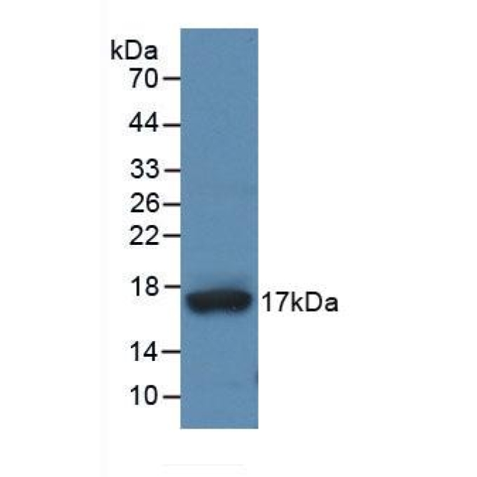 A Disintegrin And Metalloproteinase With Thrombospondin 4 (ADAMTS4) Human Monoclonal Antibody