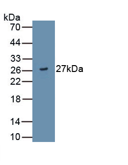 A Disintegrin And Metalloproteinase With Thrombospondin 9 (ADAMTS9) Human Monoclonal Antibody