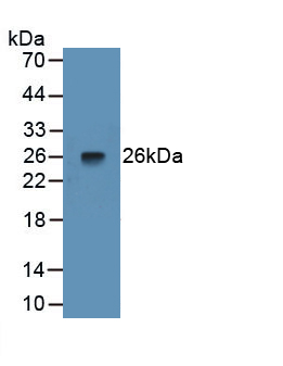 Pentraxin 3, Long (PTX3) Rat Monoclonal Antibody