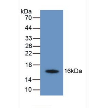 Transmembrane Protein 27 (TMEM27) Human Monoclonal Antibody