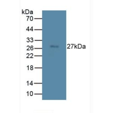 Transmembrane Protein 27 (TMEM27) Mouse Monoclonal Antibody