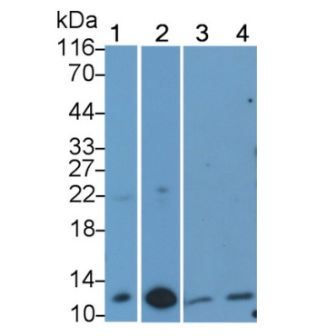 Calprotectin (CALPRO) Human Monoclonal Antibody