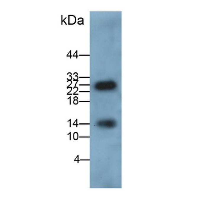 Calprotectin (CALPRO) Human Monoclonal Antibody