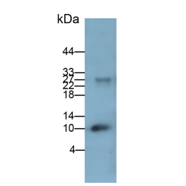 Calprotectin (CALPRO) Human Monoclonal Antibody