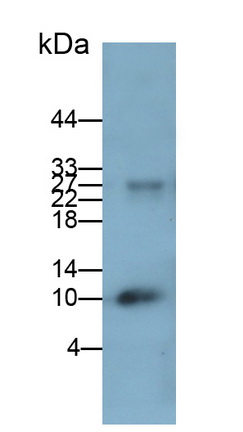 Calprotectin (CALPRO) Human Monoclonal Antibody