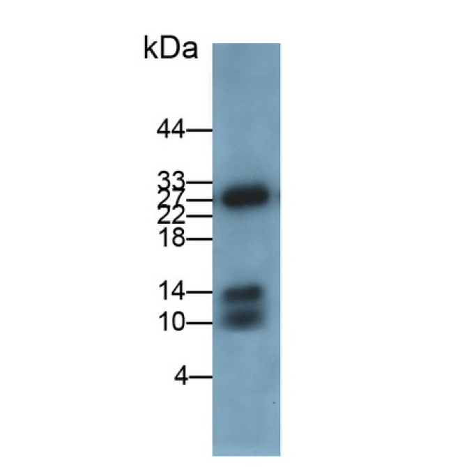 Calprotectin (CALPRO) Human Monoclonal Antibody