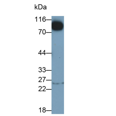 Wolfram Syndrome Protein 1 (WFS1) Human Monoclonal Antibody