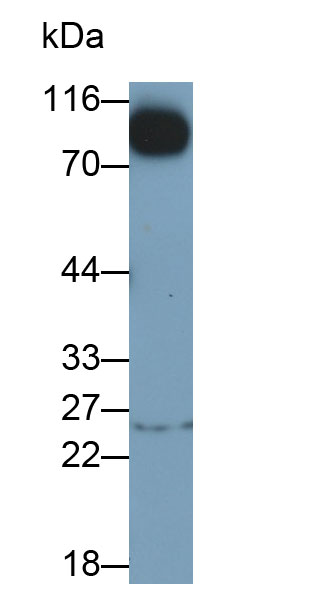 Wolfram Syndrome Protein 1 (WFS1) Human Monoclonal Antibody