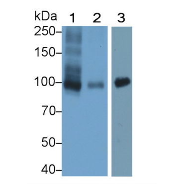 Wolfram Syndrome Protein 1 (WFS1) Human Monoclonal Antibody