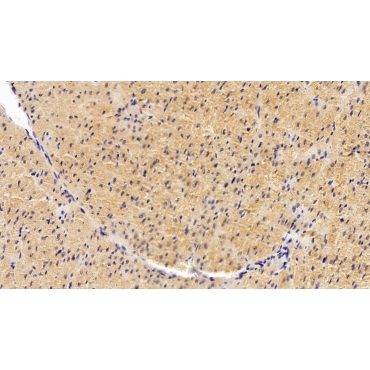 Wolfram Syndrome Protein 1 (WFS1) Human Monoclonal Antibody