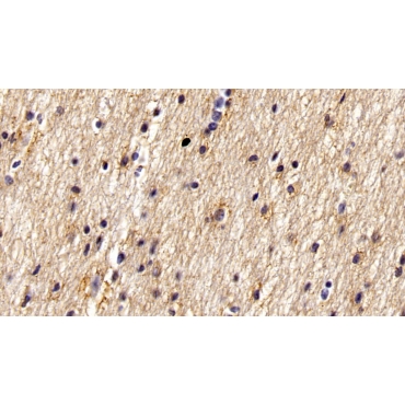 Wolfram Syndrome Protein 1 (WFS1) Human Monoclonal Antibody