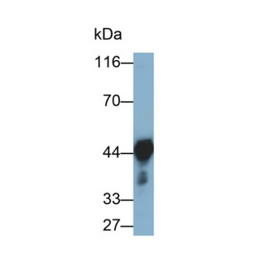 Alpha-2-Glycoprotein 1, Zinc Binding (aZGP1) Human Monoclonal Antibody