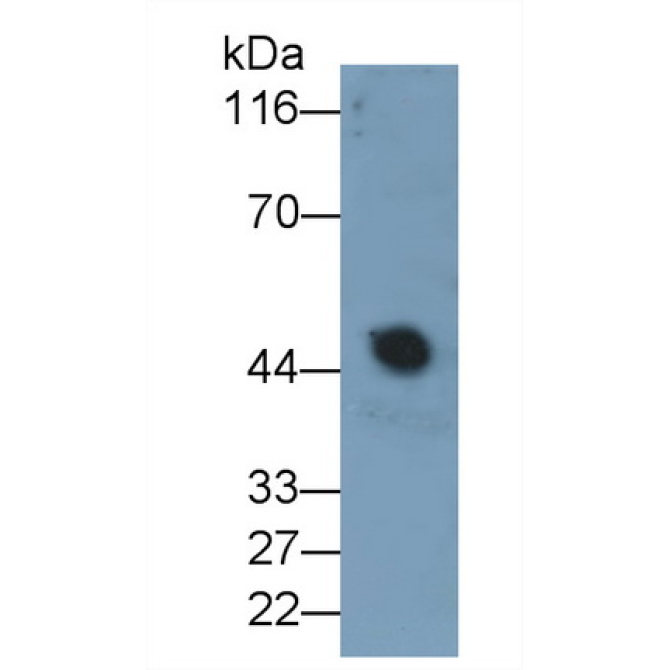 Alpha-2-Glycoprotein 1, Zinc Binding (aZGP1) Human Monoclonal Antibody