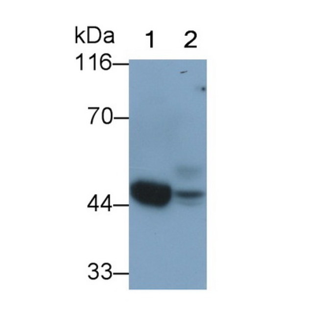 Alpha-2-Glycoprotein 1, Zinc Binding (aZGP1) Human Monoclonal Antibody