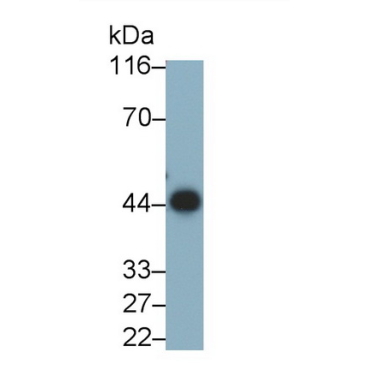 Alpha-2-Glycoprotein 1, Zinc Binding (aZGP1) Human Monoclonal Antibody