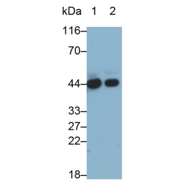 Alpha-2-Glycoprotein 1, Zinc Binding (aZGP1) Human Monoclonal Antibody