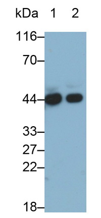 Alpha-2-Glycoprotein 1, Zinc Binding (aZGP1) Human Monoclonal Antibody