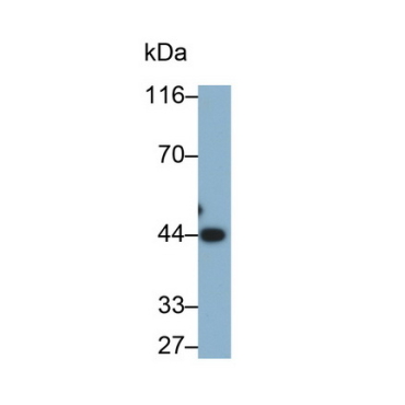 Alpha-2-Glycoprotein 1, Zinc Binding (aZGP1) Human Monoclonal Antibody
