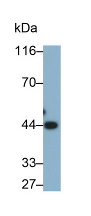 Alpha-2-Glycoprotein 1, Zinc Binding (aZGP1) Human Monoclonal Antibody