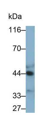 Alpha-2-Glycoprotein 1, Zinc Binding (aZGP1) Human Monoclonal Antibody