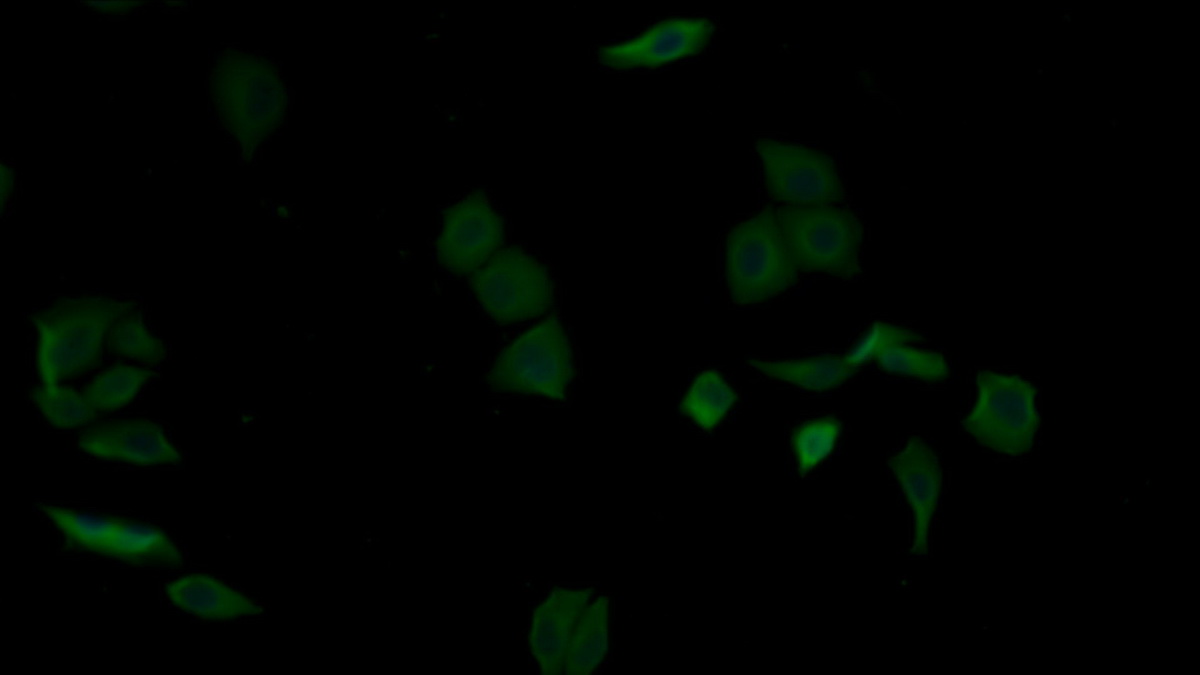 Alpha-2-Glycoprotein 1, Zinc Binding (aZGP1) Rat Monoclonal Antibody