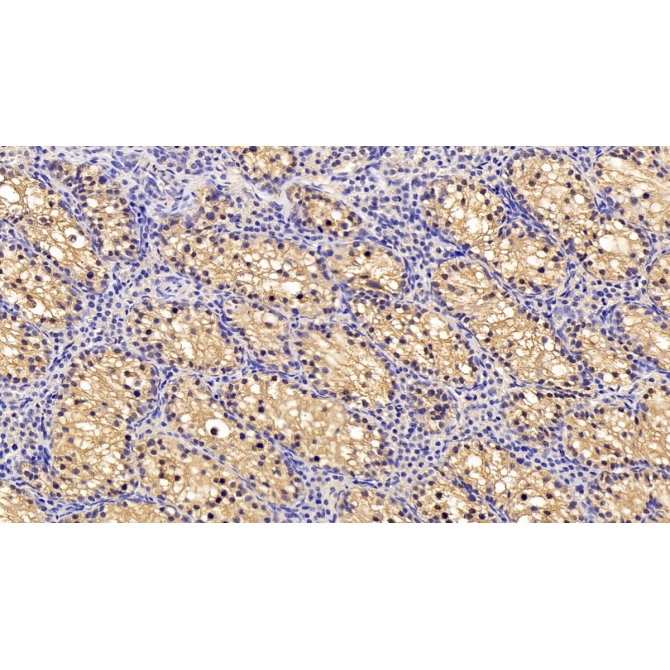 Chaperonin Containing TCP1, Subunit 2 (CCT2) Human Monoclonal Antibody