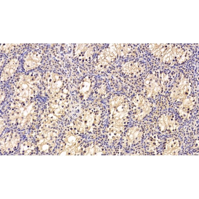 Chaperonin Containing TCP1, Subunit 2 (CCT2) Human Monoclonal Antibody