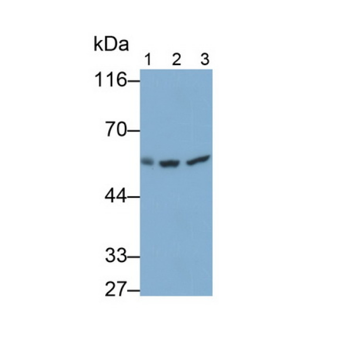 Chaperonin Containing TCP1, Subunit 2 (CCT2) Human Monoclonal Antibody