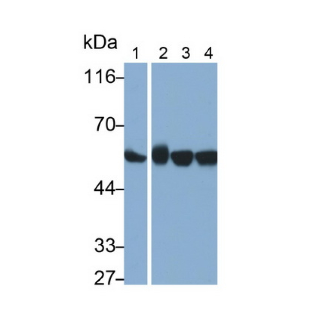Chaperonin Containing TCP1, Subunit 2 (CCT2) Human Monoclonal Antibody
