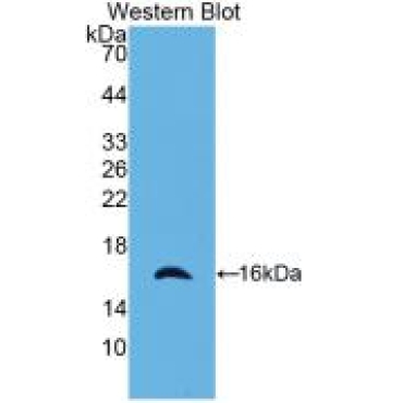 CASP2 And RIPK1 Domain Containing Adaptor With Death Domain Protein (CRADD) Human Monoclonal Antibody