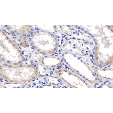 Endoplasmic Reticulum Lipid Raft Associated Protein 2 (ERLIN2) Human Monoclonal Antibody