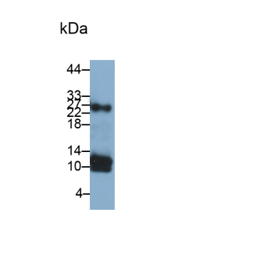 Hypomagnesemia 2, Renal (HOMG2) Human Monoclonal Antibody