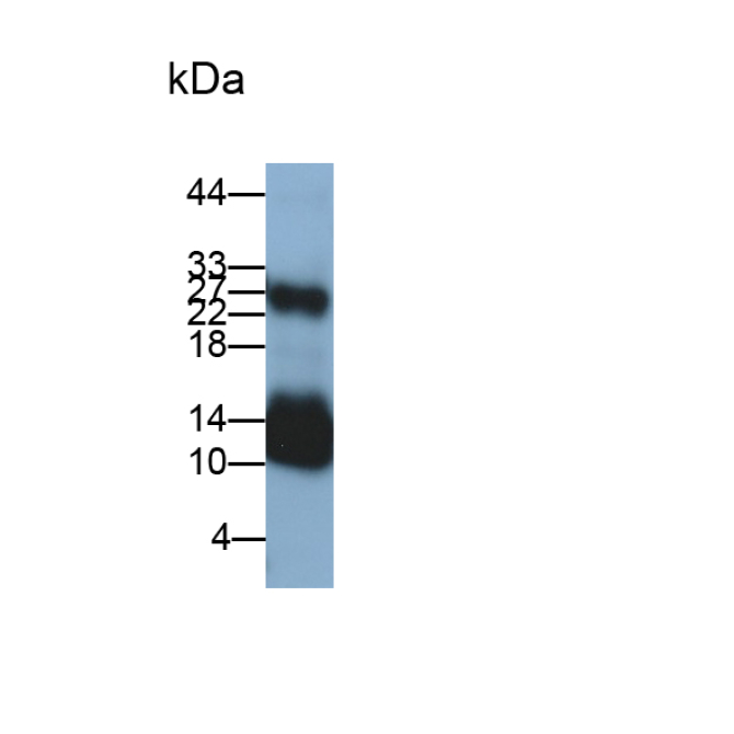 Hypomagnesemia 2, Renal (HOMG2) Human Monoclonal Antibody
