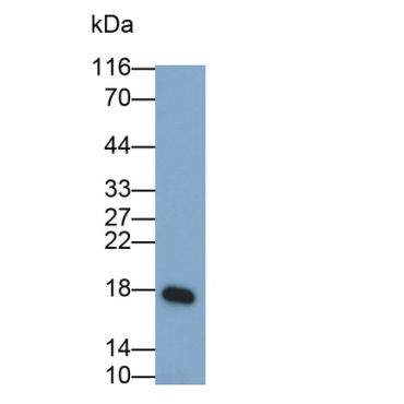 Interleukin 1 Family, Member 9 (IL1F9) Human Monoclonal Antibody