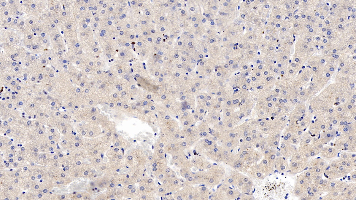 Wingless Type MMTV Integration Site Family, Member 4 (WNT4) Human Monoclonal Antibody