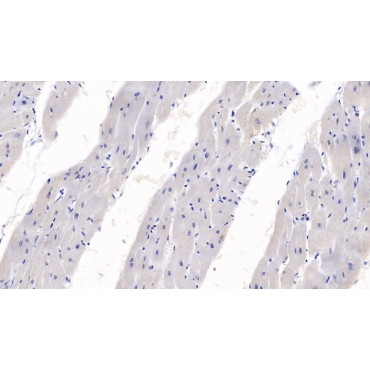 Semaphorin 3A (SEMA3A) Human Monoclonal Antibody