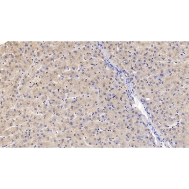 Semaphorin 3A (SEMA3A) Human Monoclonal Antibody