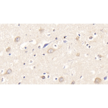 Semaphorin 3A (SEMA3A) Human Monoclonal Antibody