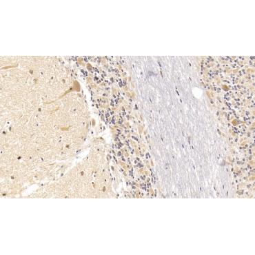 Semaphorin 5B (SEMA5B) Human Monoclonal Antibody