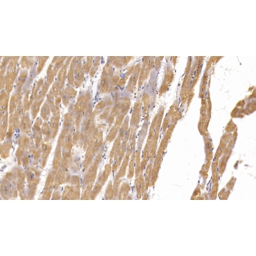 Semaphorin 5B (SEMA5B) Human Monoclonal Antibody