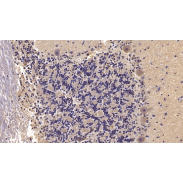 Semaphorin 5B (SEMA5B) Human Monoclonal Antibody