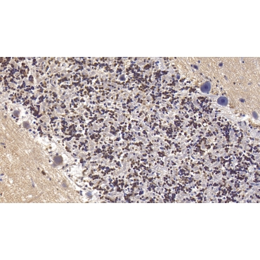 Semaphorin 5B (SEMA5B) Human Monoclonal Antibody