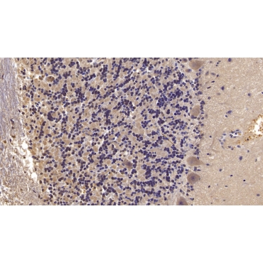 Semaphorin 5B (SEMA5B) Human Monoclonal Antibody