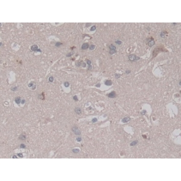 V-Ral Simian Leukemia Viral Oncogene Homolog A (RALA) Human Monoclonal Antibody