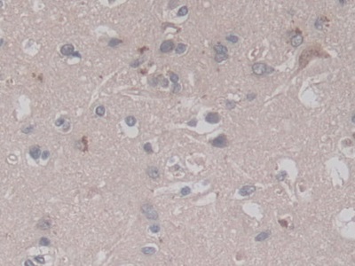 V-Ral Simian Leukemia Viral Oncogene Homolog A (RALA) Human Monoclonal Antibody